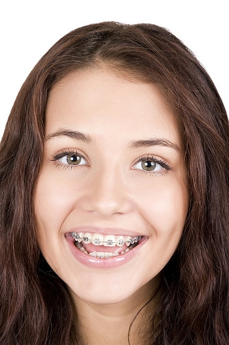teen girl with braces smiling